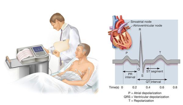 Électrocardiographie pour reconnaître les maladies cardiovasculaires avec une pression artérielle élevée